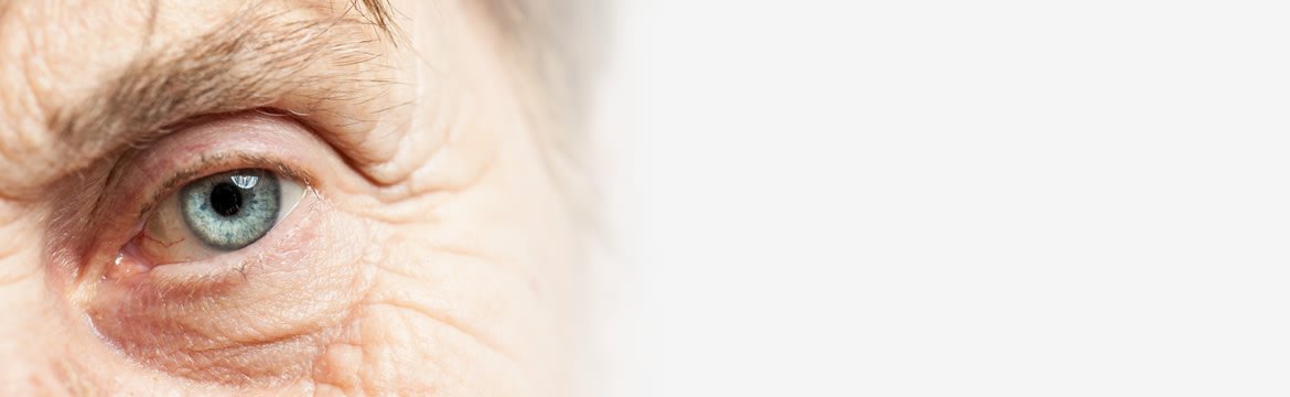 Cataract Surgery & Refractive Lens Exchange
